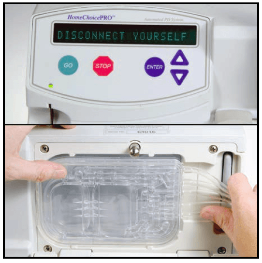 Baxter HomeChoice PRO APD System User Manual-30