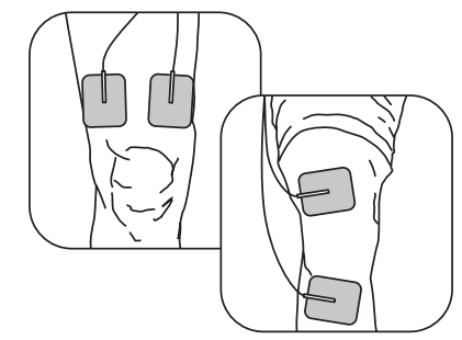 Auvon SM9126 Rechargeable TENS Unit Muscle Stimulator 13