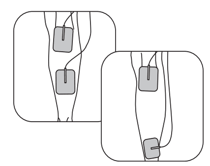 Auvon SM9126 Rechargeable TENS Unit Muscle Stimulator 14