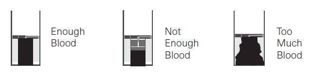 Relion Prime Blood Glucose Monitoring System-27