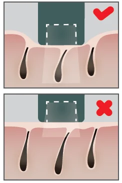 Ulike IPL Laser Hair Removal Device User Manual Ulike IPL Laser Hair Removal Device 21