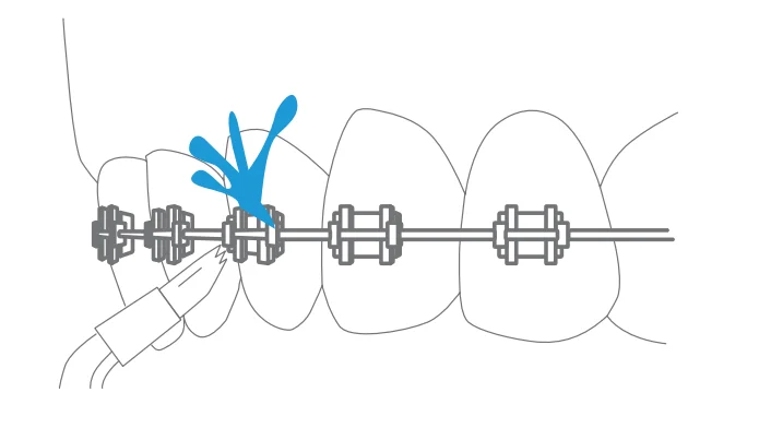 Dartwood Cordless Oral Irrigator User Manual Dartwood Cordless Oral Irrigator 9